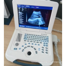 Low price mini laptop ultrasound scanner